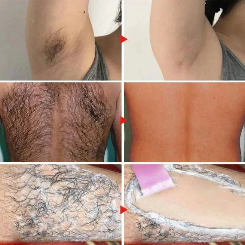 Painless Permanent Depilatory Cream